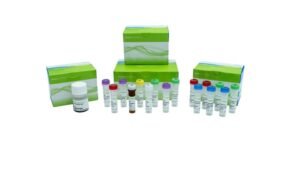 KAPA RNA EvoPrep Kit with RiboErase (HMR) Globin